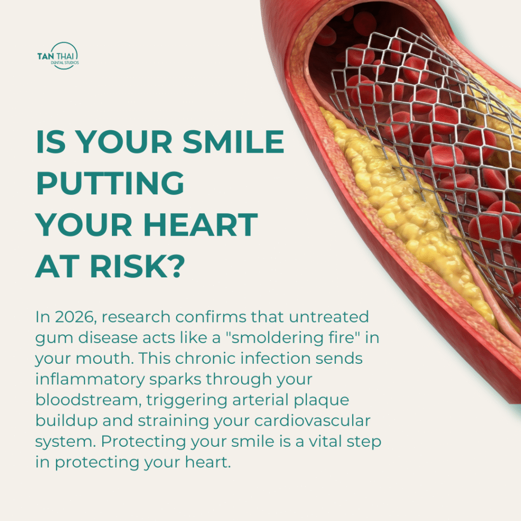 An educational graphic titled "Is Your Smile Putting Your Heart At Risk?" showing a cross-section of an artery with plaque buildup and a medical stent.